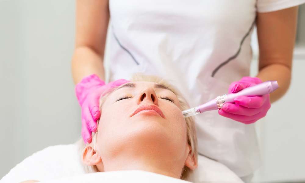 How Much Does Microneedling Cost In Florida?