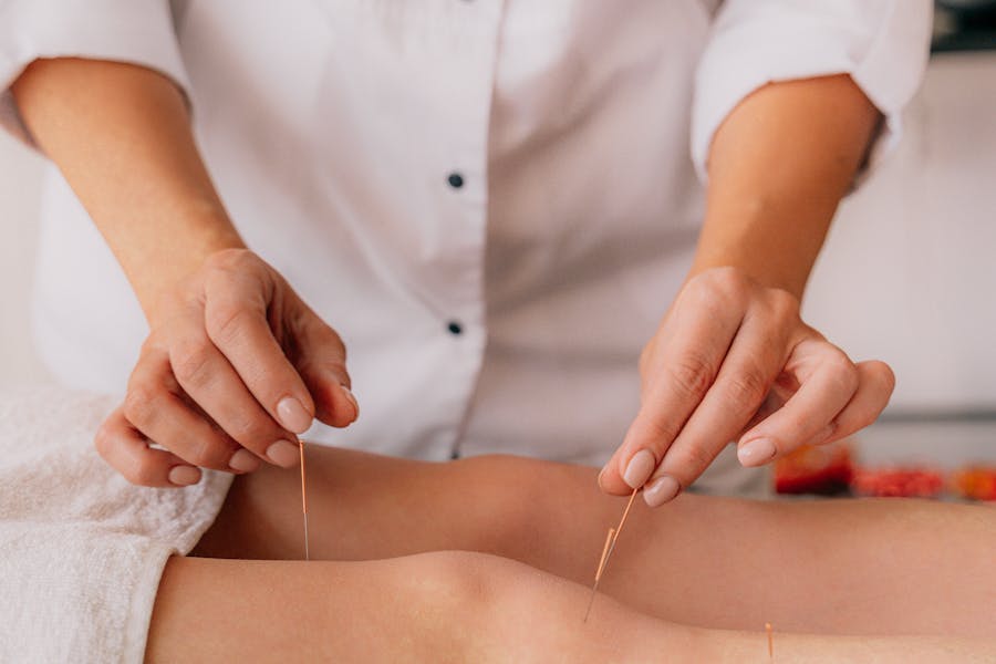 The Benefits of Acupuncture for Stress Relief and Wellness